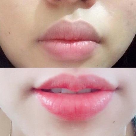 Serum dưỡng #căng #mọng và làm #hồng #môi Eveline Hyaluron Lip Push Up