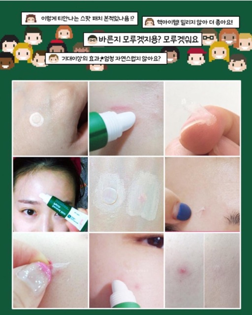 Gel dán mụn thần thánh Prreti Second Skin Patch 10g | BigBuy360 - bigbuy360.vn