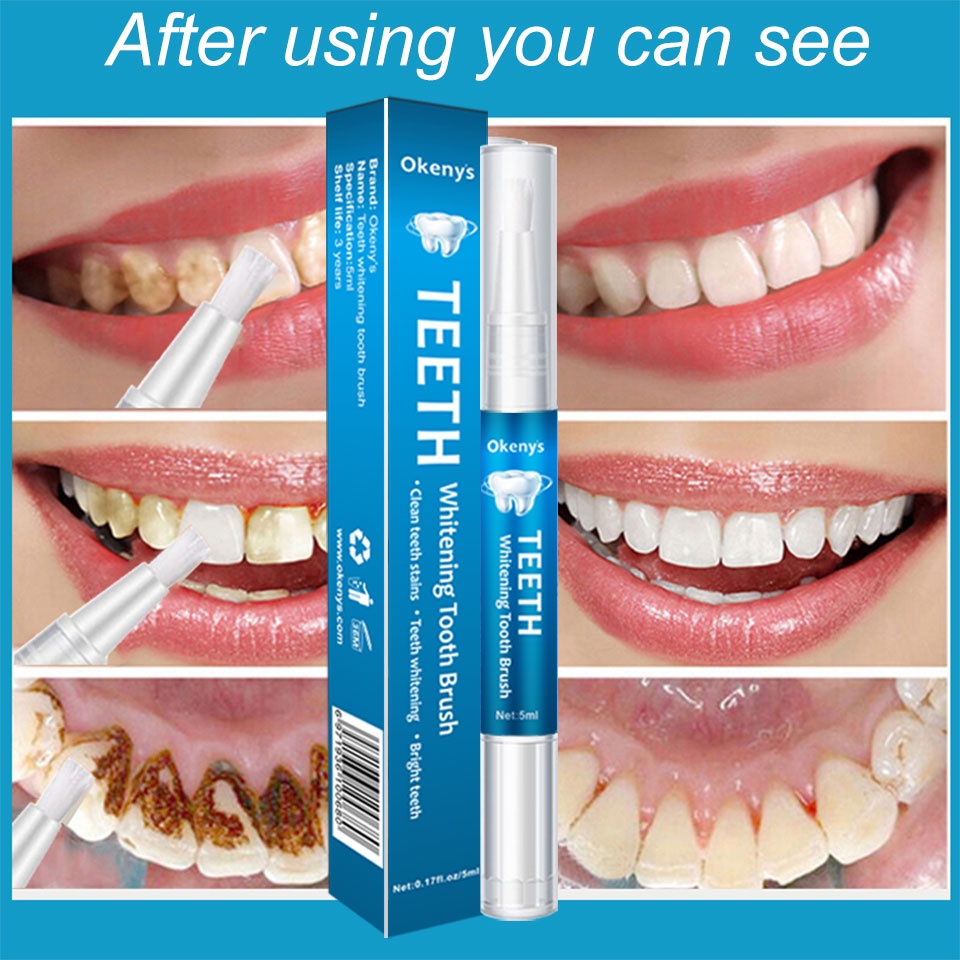 Bút Làm Trắng Răng 3D 5ml Giúp Loại Bỏ Mảng Bám Và Làm Trắng Răng