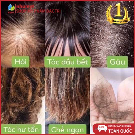 ( Combo 3sp ) DẦU GỘI BỒ KẾT CÔ ĐẶC + TINH DẦU BƯỞI + DẦU XẢ SỮA DỪA kích thích mọc tóc, làm mềm mượt tóc , ... .