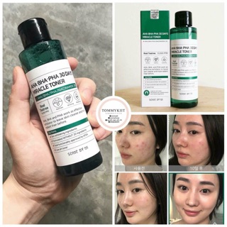 Toner Trị nun AHA - BHA-PHA 30days miracle Toner