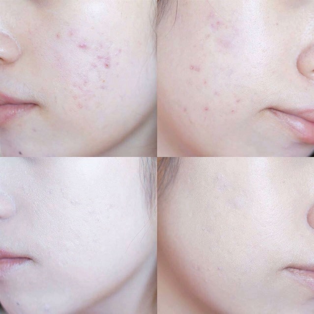 CHE KHUYẾT ĐIỂM BÚT 2 ĐẦU SKIN PERFECTION CONCEALER KARADIUM | BigBuy360 - bigbuy360.vn