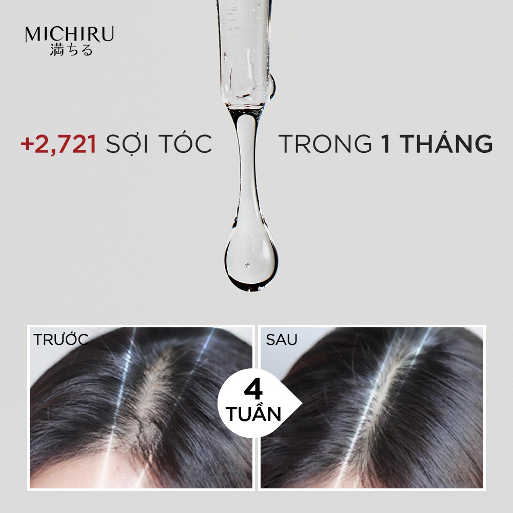 Serum Michiru nội địa Nhật ngăn ngừa rụng tóc sau 1 tháng với DynaZinc 45ml