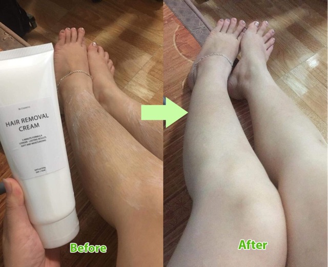 [Mã SKAMLTSM9 giảm 10% đơn 99K] Set tẩy lông BE (kem + serum ) | BigBuy360 - bigbuy360.vn