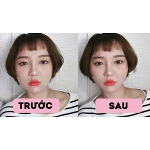 [HOT] Miếng dán mặt thon gọn mặt V-line