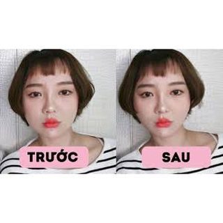 [HOT] Miếng dán mặt thon gọn mặt V-line