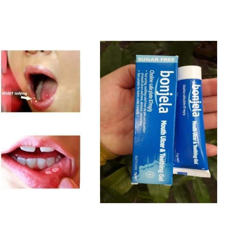 GEL BÔI NHIỆT MIỆNG BONJELA - Gel bôi nhiệt miệng và mọc răng Bonjela cho bé từ 4 tháng tuổi trở lên hàng Úc 15gr