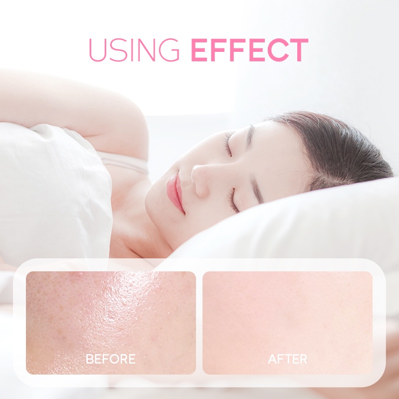 Mặt Nạ Ngủ Hoa Anh Đào 3g Fenyi