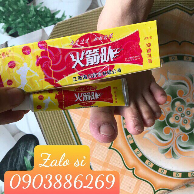 Kem bôi tổ đỉa, vẩy nến, nấm chân tay, nứt nẻ, á sừng, nấm da... Hàng có sẵn - Hàng có sãn