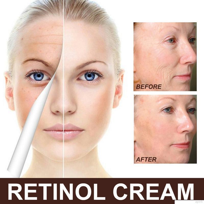Kem Retinol Dưỡng Ẩm Chống Lão Hóa Nuôi Dưỡng Da Mịn Màng 30g