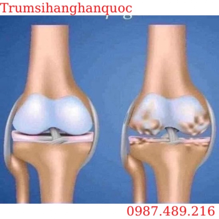 [HÀNG MỚI VỀ] Viên Uống Bổ Khớp Glucosamin KWANGDONG Hàn Quốc [ Hàng Mới Về ]
