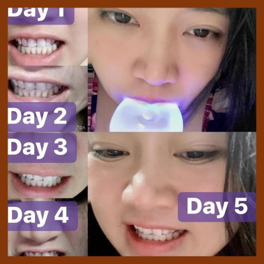 [ Hàng ÚC] Máy làm trắng răng bằng ánh sáng xanh White Glo White Accelerator Blue Light Teeth Whitening System