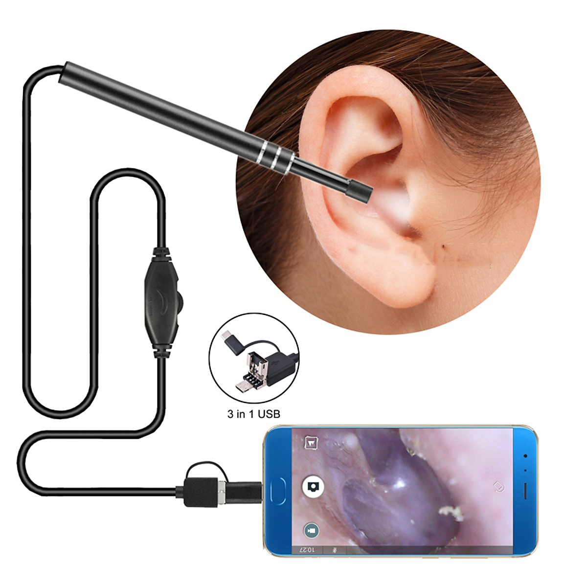 Camera nội soi siêu nhỏ 5.5 mm, Camera nội soi y tế soi tai, mũi, họng kiêm Máy lấy ráy tai HD