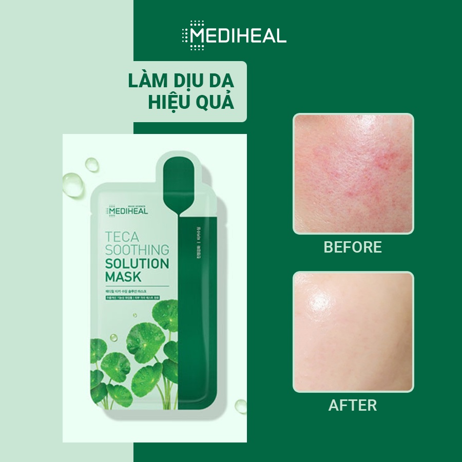 Mặt Nạ Mediheal Teca Soothing Solution Mask Dành Cho Da Mụn 23ml x10 Miếng