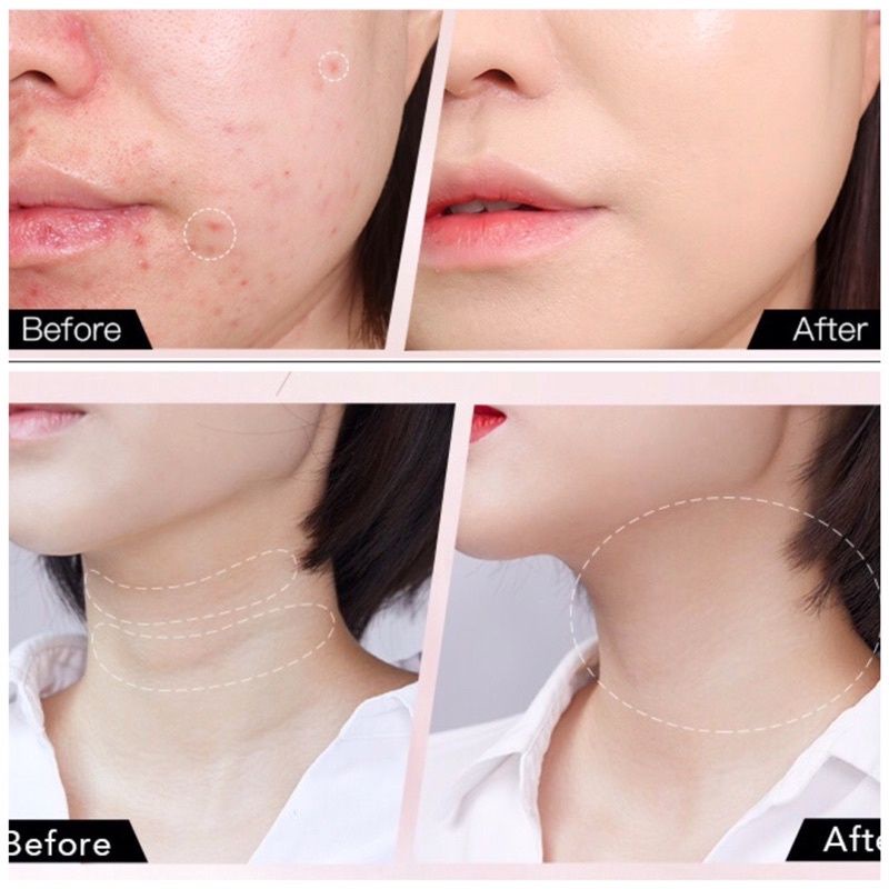 Bút chì che khuyết điểm có đầu gọt tiện dụng, che phủ vết thâm quầng, đồi mồi trên da