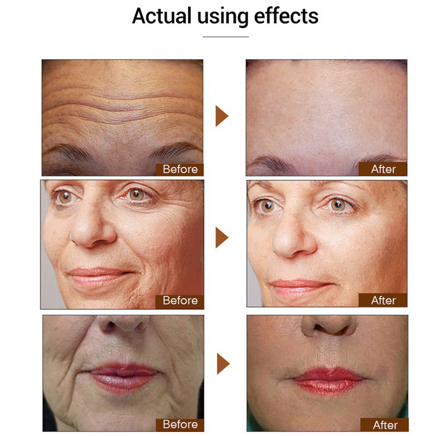 Six Tinh Chất peptide 100ml Chống Nếp Nhăn Chống Lão Hóa Làm Săn Chắc Da Mặt