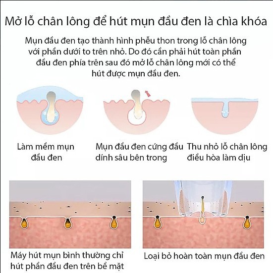 MÁY HÚT MỤN ĐA NĂNG