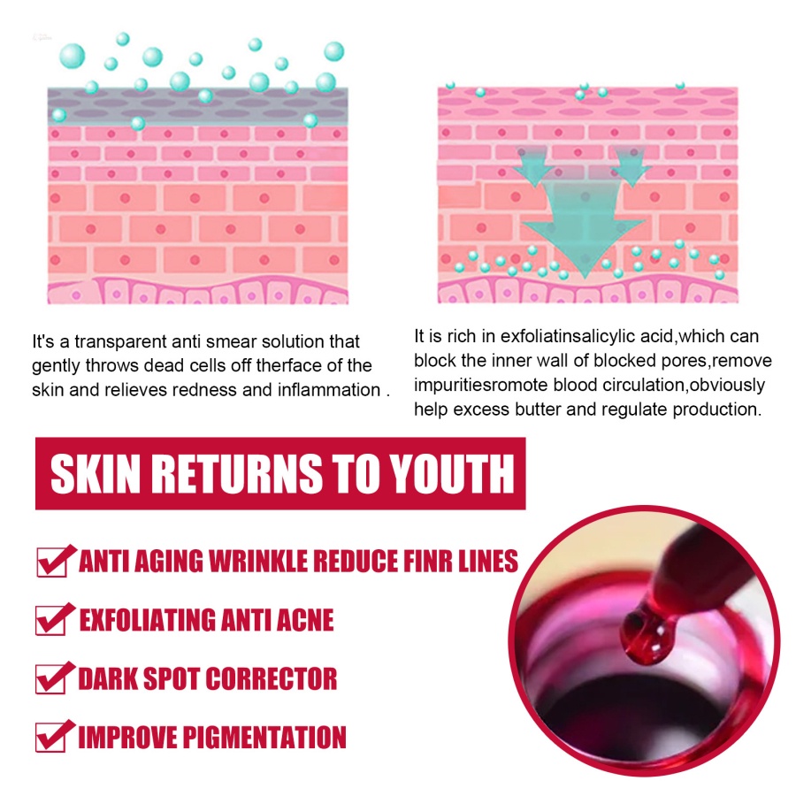 Tinh Chất Axit Hyaluronic 30% + BHA 2% Axit Salicylic Giúp Hỗ trợ giảm mụn Hiệu Quả
