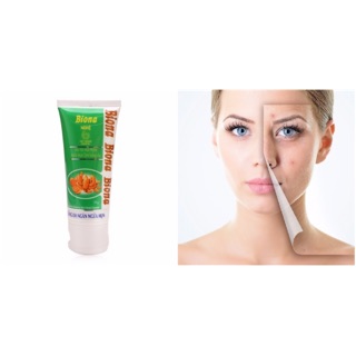 Sữa rửa mặt ngừa mụn trắng da biona nghệ