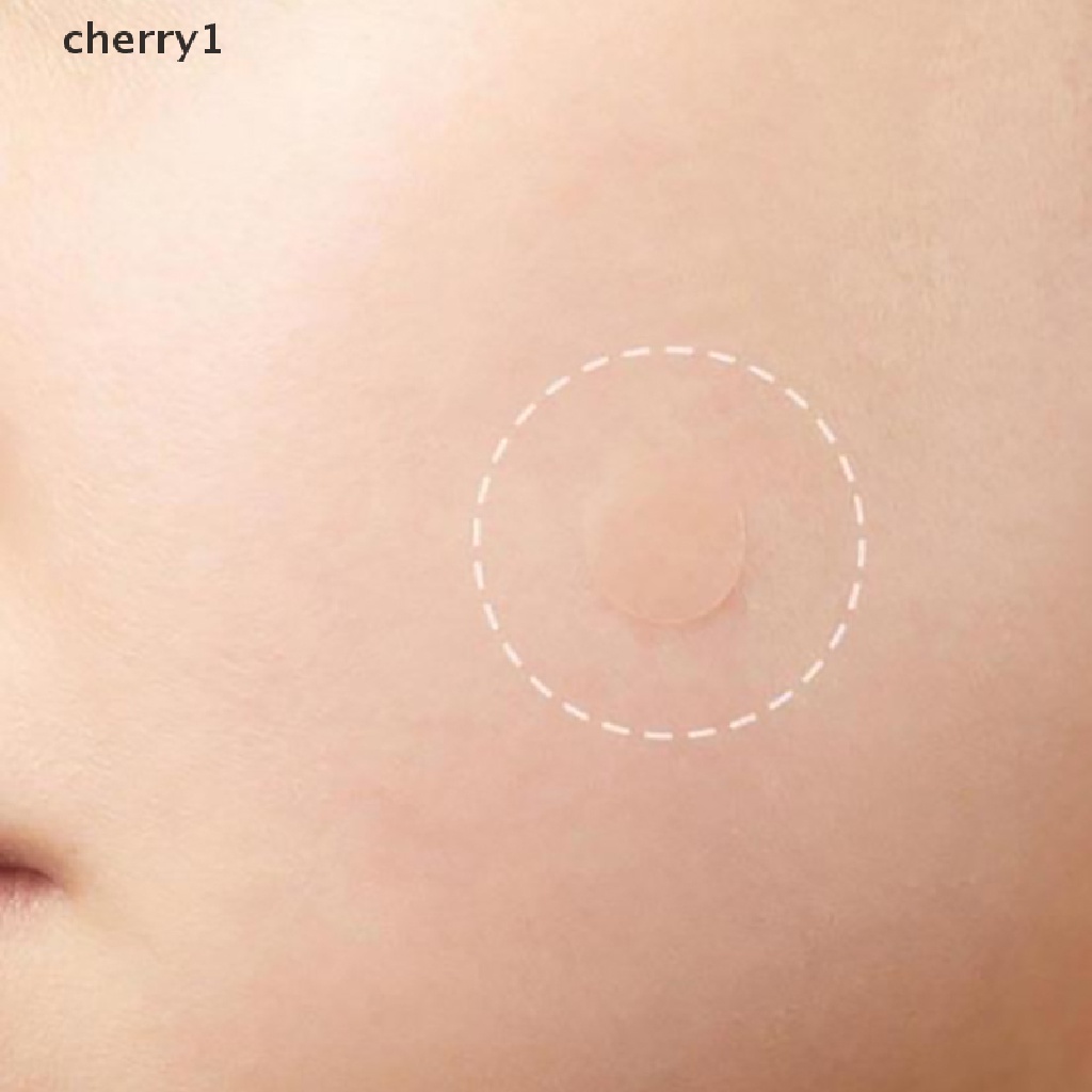 Bộ 36 Miếng Dán Hỗ trợ giảm mụn Hiệu Quả Tiện Dụng