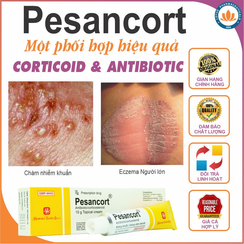 Kem Bôi Ngoài Da Pesancort - Lotuspharma