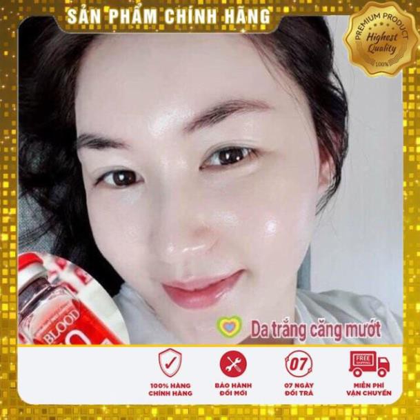 Tế bào gốc máu Blood O - huyết tương giàu tiểu cầu (hộp 15 lọ)