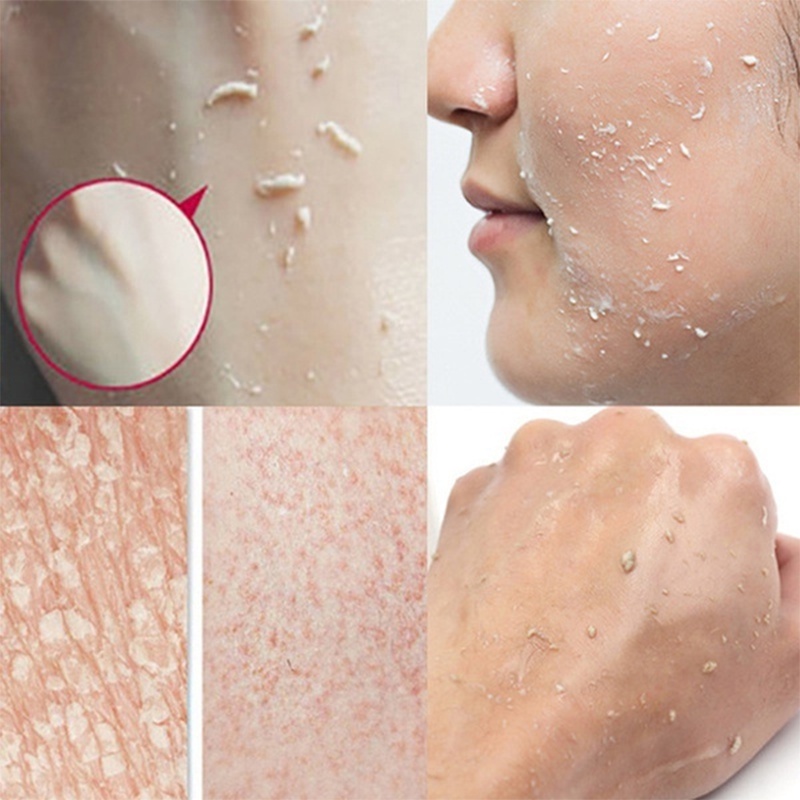 Kem tẩy tế bào chết HLLR chiết xuất quả mâm xôi tự nhiên làm sạch sâu 200g