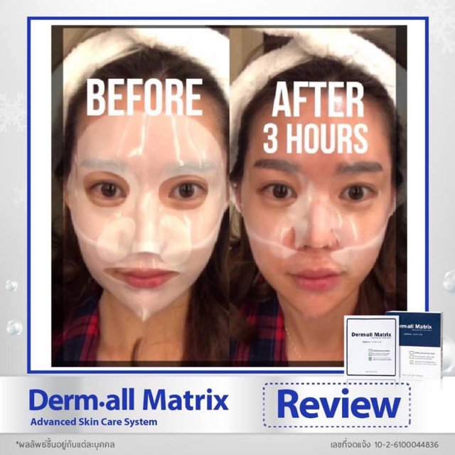 DERM ALL MATRIX / Mặt Nạ Mask Derm-all Matrix - Hộp 4 Miếng Mẫu Mới