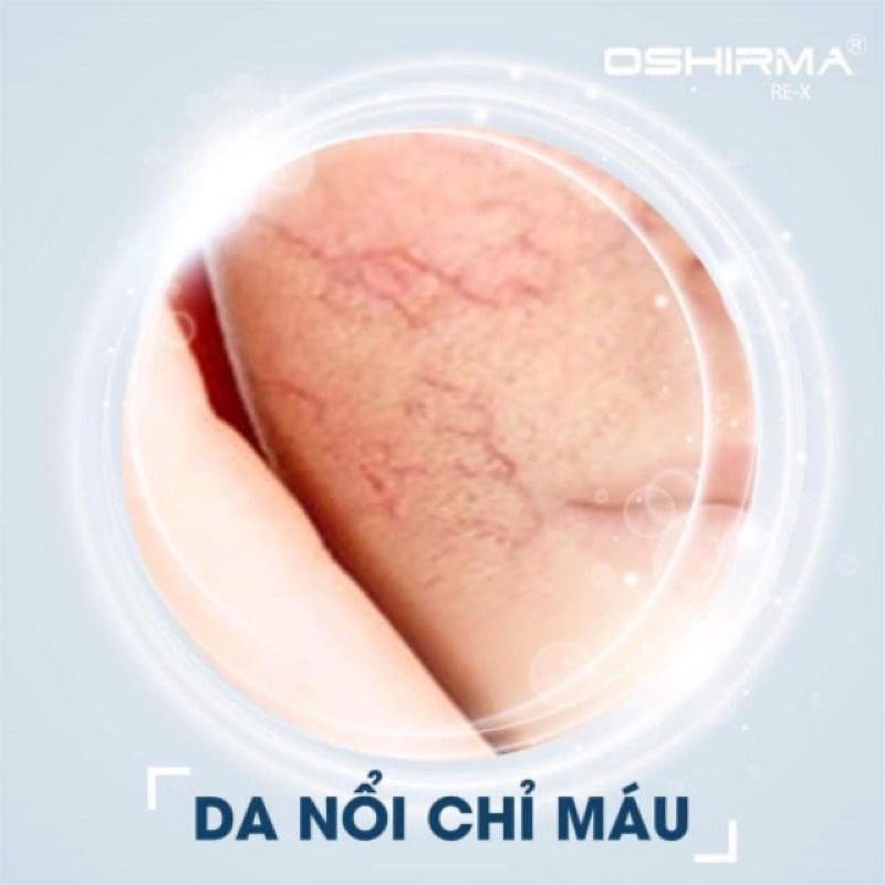 Kem Tái Tạo Da Hư Tổn Oshima 18g (Sử dụng ban đêm)