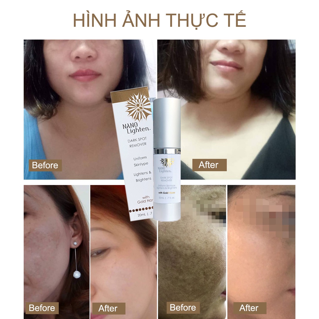 Serum Mờ Nám,Tàn Nhang Nano Lighten Dark Spot Remover 20ml