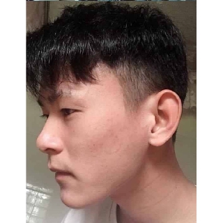 [FREESHIP] LÀM SẠCH THÂM MỤN CHÍNH HÃNG