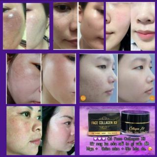 Kem dưỡng Face Collagen X3