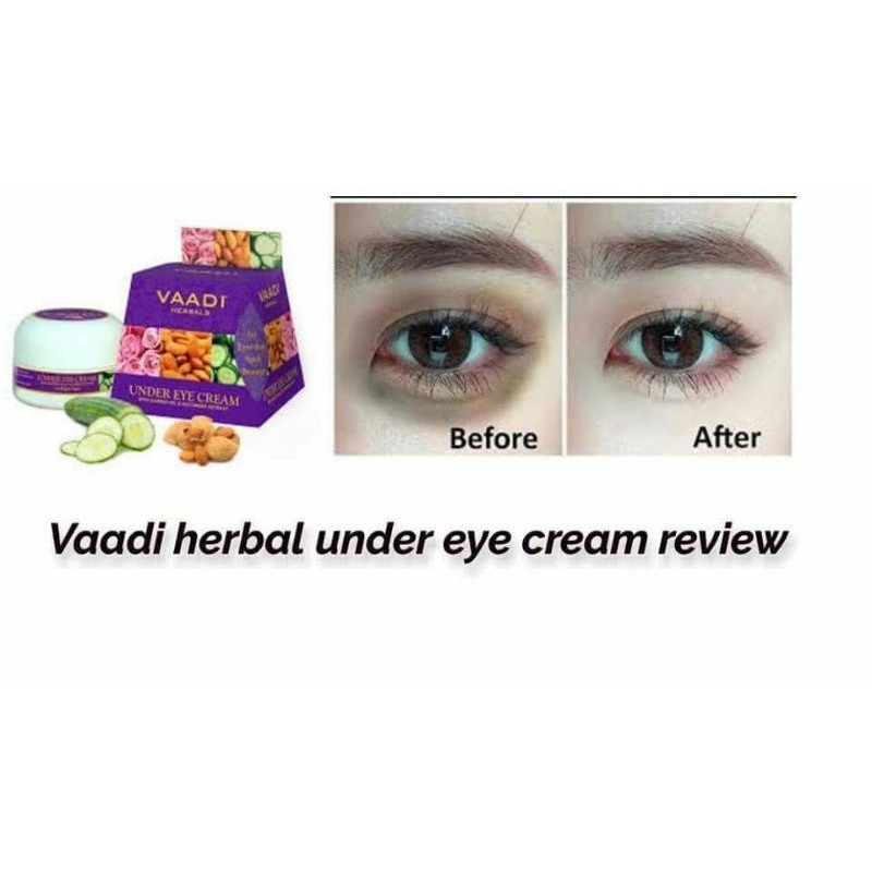 [Hàng chuẩn] Kem trị quầng thâm mắt và bọng mắt hãng Vaadi Ấn Độ