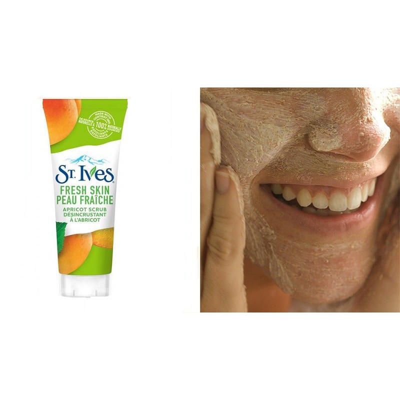 Sữa Rửa Mặt Tẩy Da Chết St.Ives Acne Control/ Fresh Skin Apricot Scrub 170g (NEW COLOR) - MYLA SHOP