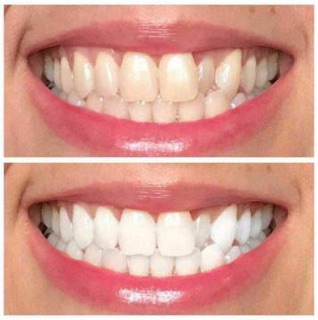 Kem đánh răng AP24 của Mỹ