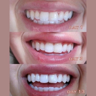 (Mẫu mới) Kem đánh răng Crest 3D White Advanced  Whitening 147g