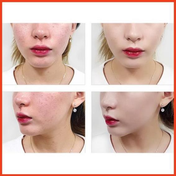 ( Lyngocduyen ) Phấn nước mịn mượt da chống nắng _AGC ANGRECI BB