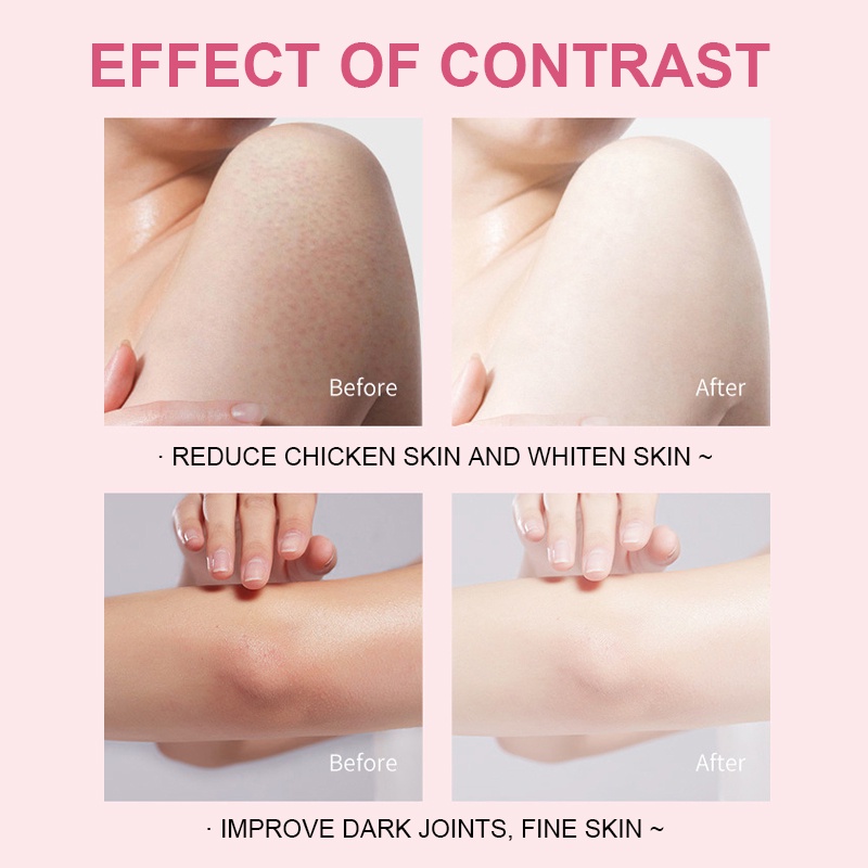 Kem SEVICH chiết xuất 90% hyaluronic acid tẩy tế bào chết làm trắng da toàn thân 200g