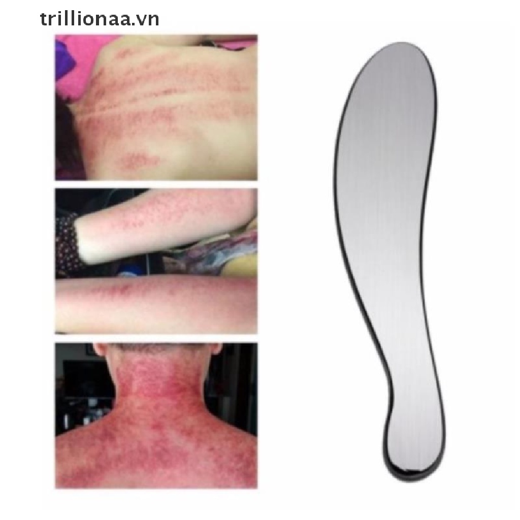 [Hàng mới về] Dụng cụ mát xa cạo gió bằng thép tiện dụng cho gia đình