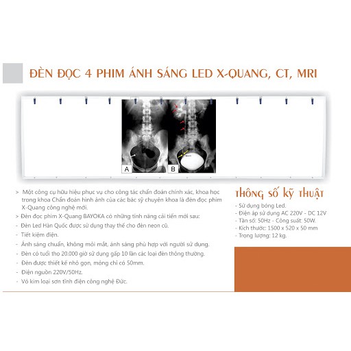 Đèn đọc phim X-Quang CT MRI ánh sáng LED Bayoka