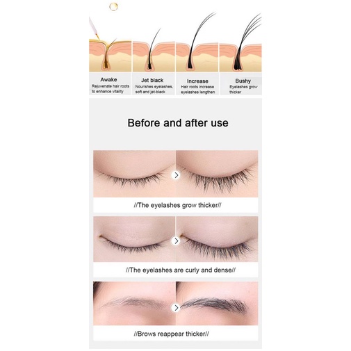 [Hàng mới về] Serum Kích Thích Mọc Lông Mi Hiệu Quả | BigBuy360 - bigbuy360.vn