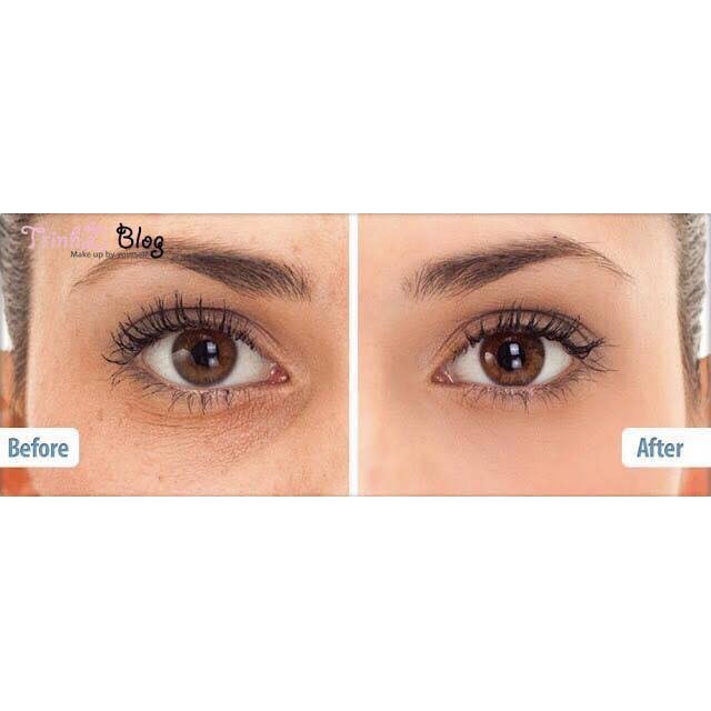 Kem Mắt Nọc Rắn Balance Active Formula Snake Venom Eye Cream 15ml