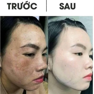 SERUM COLAGEL VIT E