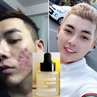 (Mẫu mới) Combo detox blanc số 1 & 13 ( cam kết chính hãng)