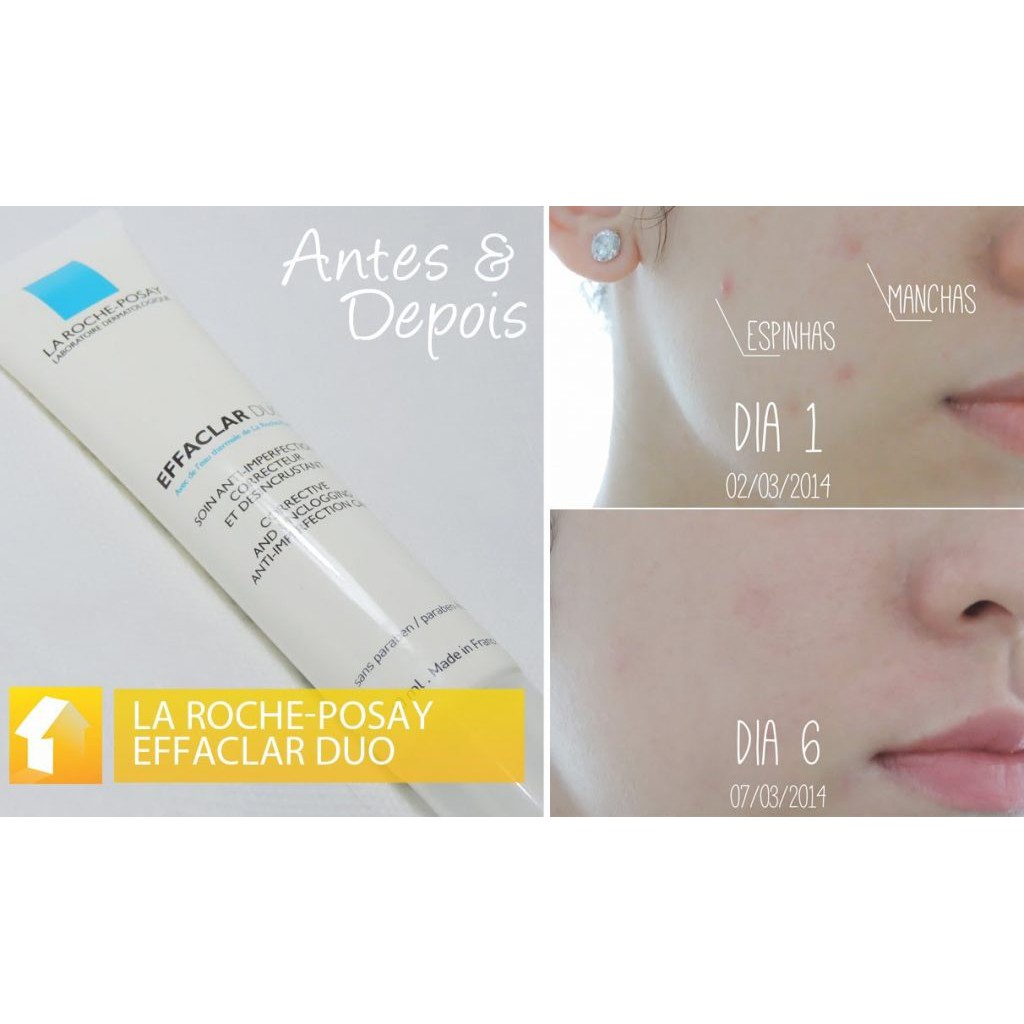 Kem Hỗ Trợ Xóa Mụn La Roche Posay Effaclar Duo+ 15ml