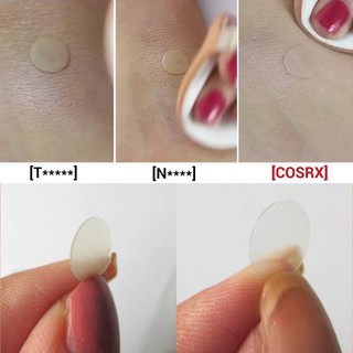 Miếng dán mụn Cosrx Master Patch 24 miếng hút mủ tốt