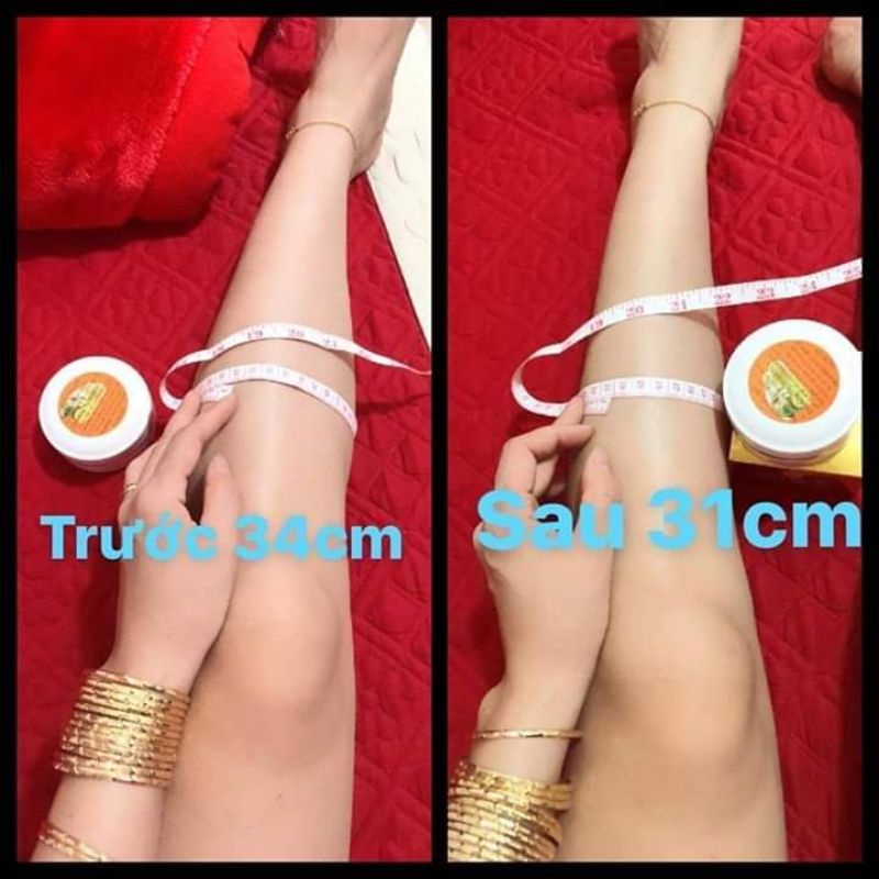 Kem ủ tiêu mỡ gia Hân .+đai nịt bụng