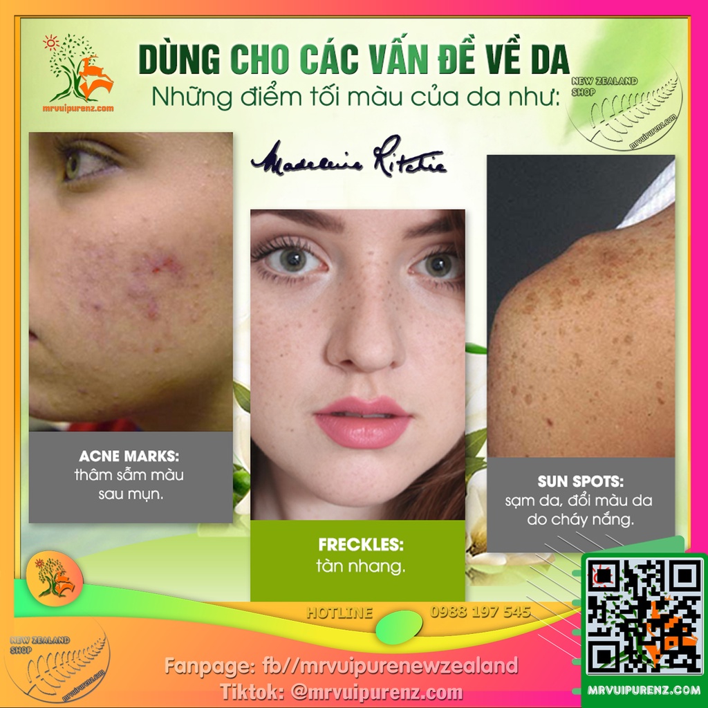 KEM DƯỠNG LÀM MỜ VẾT THÂM, GIẢM TÀN NHANG MADELEINE RITCHIE DARK SPOT REMOVER | BigBuy360 - bigbuy360.vn
