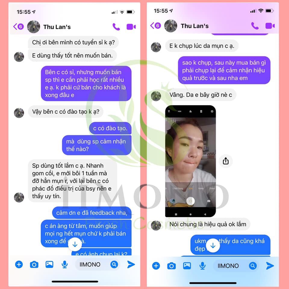 Bộ chăm sóc da mụn, giảm thâm mụn IIMONO | BigBuy360 - bigbuy360.vn