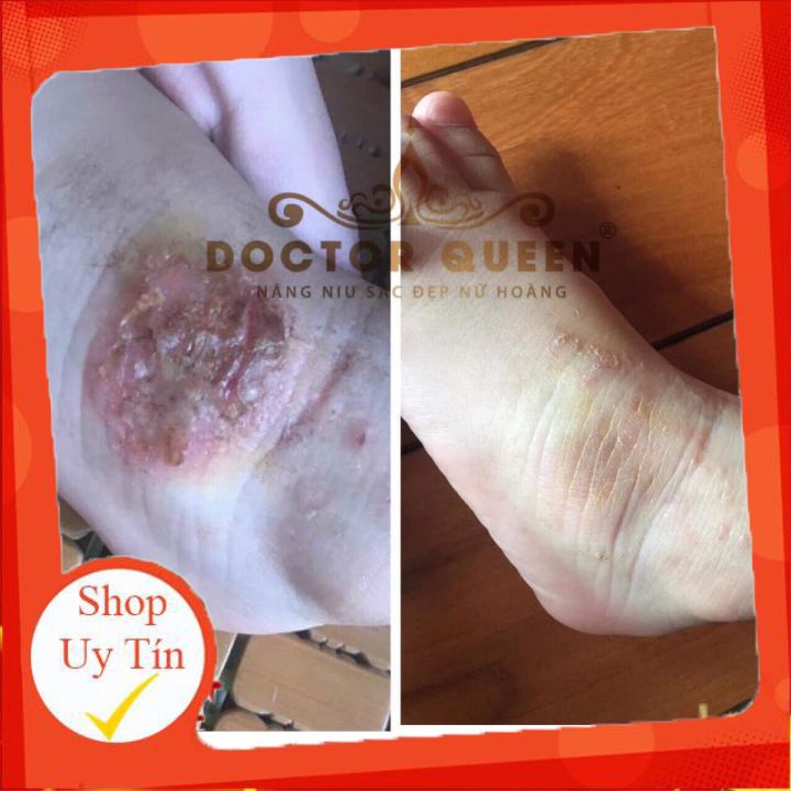 CAO NGHỆ DOCTORQUEEN 🔥𝐍𝐄𝐖🔥